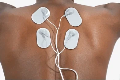 Electrical Stimulation Therapies