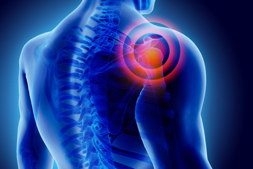 Shoulder Pain Treatments