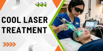 Cold Laser Treatment